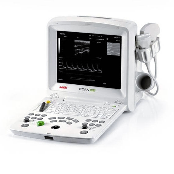 DUS60 Digitální Diagnostický Ultrazvukový Systém