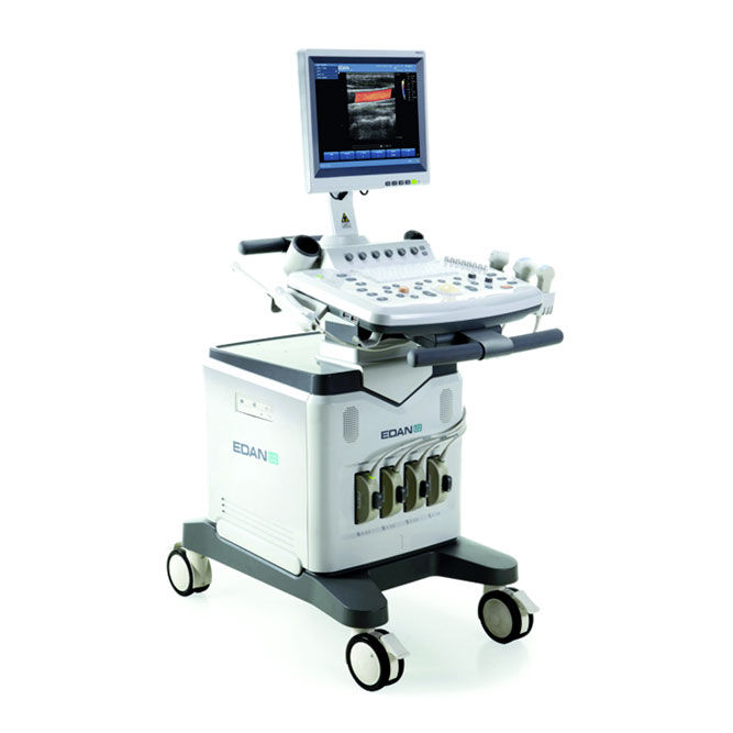U2 Prime Diagnostický Ultrazvukový Systém