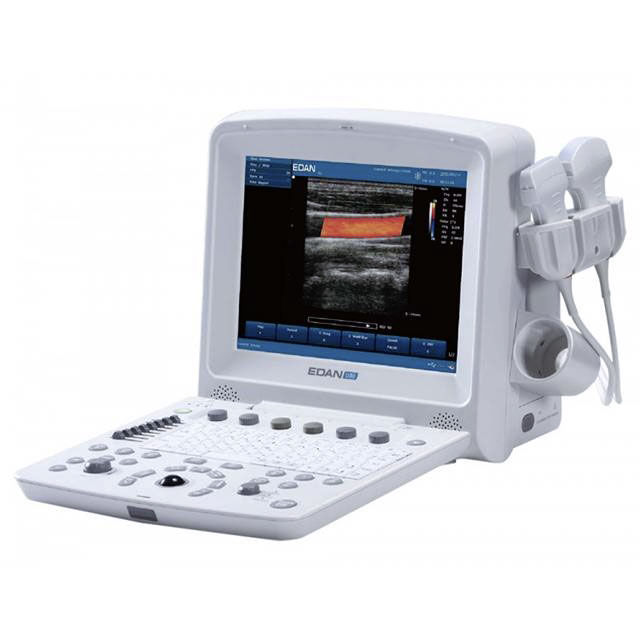 U50 Prime Diagnostický Ultrazvukový Systém